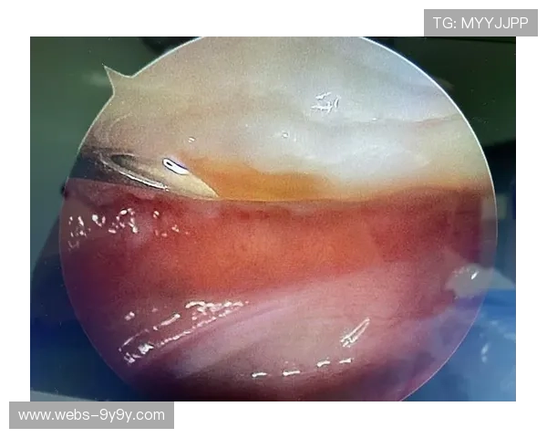 运动医学进步助力球员伤病恢复加速,缩短恢复周期 运动医学进步助力球员伤病恢复加速,缩短恢复周期